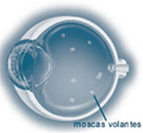 moscas-volantes jj